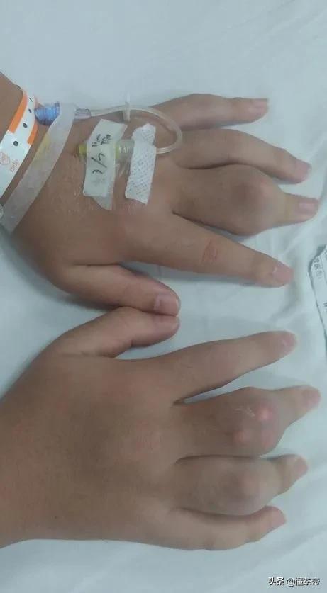 喝奶茶的危害真实事例,长期喝奶茶致癌是真的吗