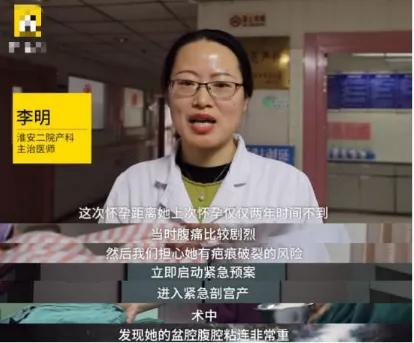 郑嘉颖老婆两年剖两胎？这样很危险