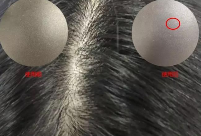 去屑洗发水专业测评,头屑克星去屑止痒洗发水干性皮肤