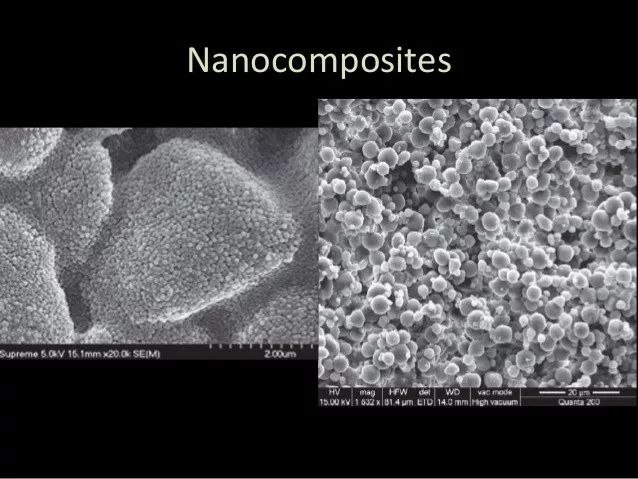 门牙补牙用什么材料最好,补牙的材料选哪种更好