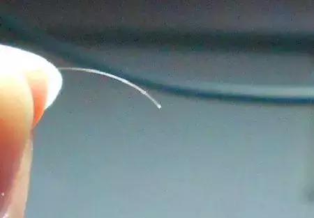 脱发后怎么判断毛囊是否萎缩,雄激素脱发的毛囊萎缩症状