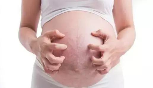 孕期阴道分泌物增多，准妈妈要注意这四点！还有可能是快生了！