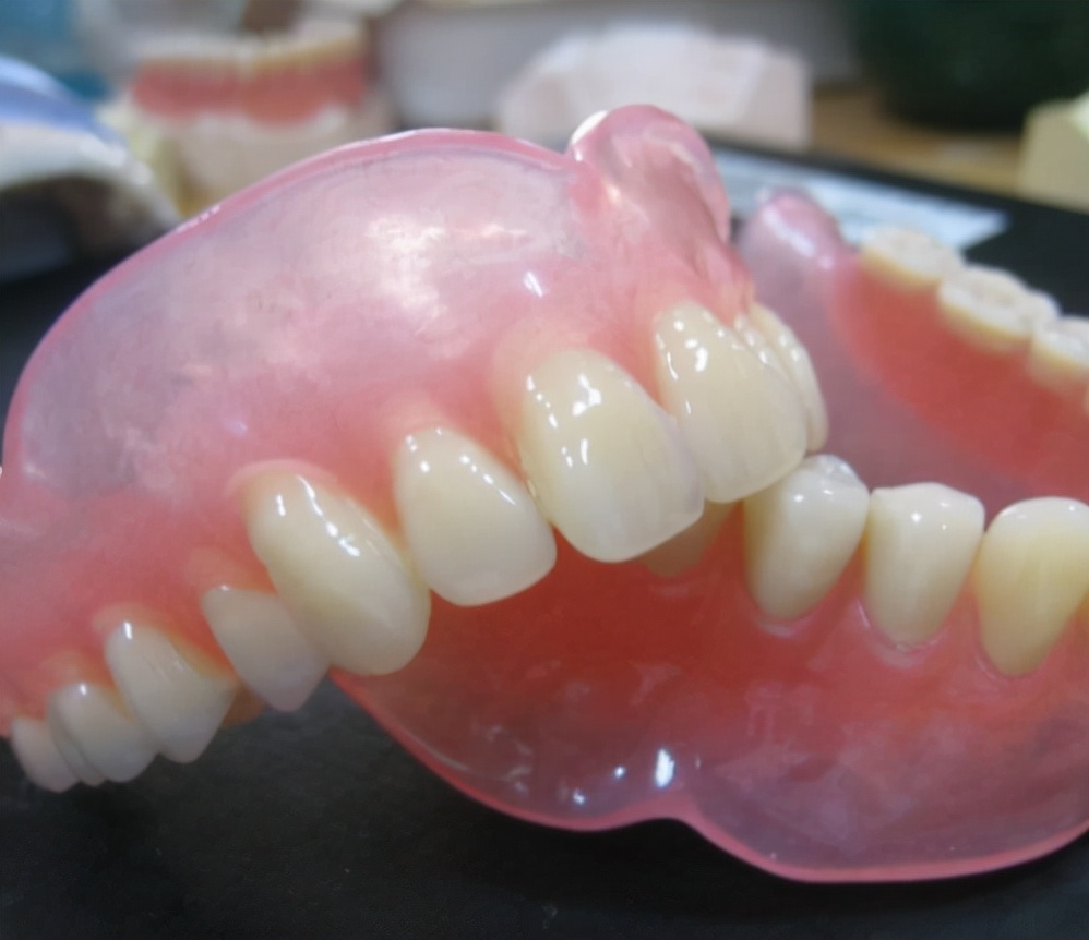 老人做种植牙有什么年龄限制吗,老年人做种植牙有什么风险