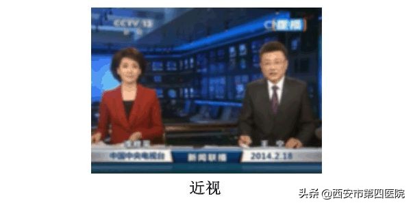 中医认为散光是怎么导致的,医生怎么发现散光