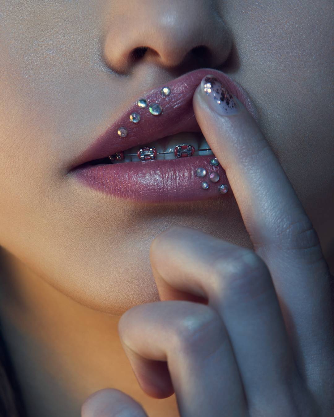 牙齿正畸必备品,正畸期间必备品