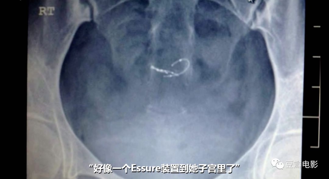 豆瓣9.0，揭露医疗*局骗**，这片太血淋淋