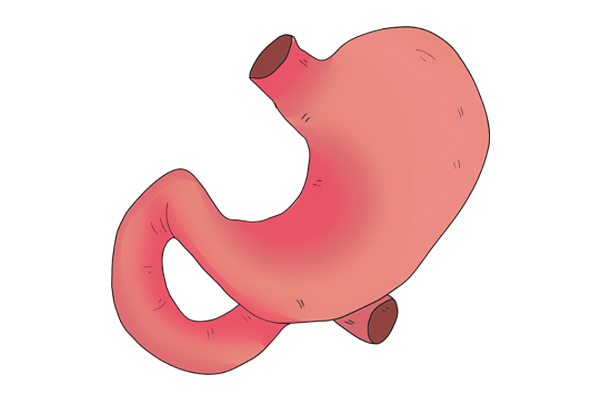 胃阴虚和胃阳虚的症状怎么调理,胃阴虚和胃阳虚的关键区别是什么