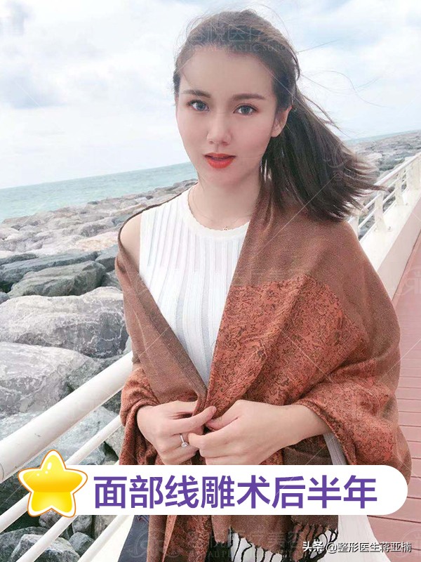 线雕完觉得自己像阿凡达,线雕的真实感受图片