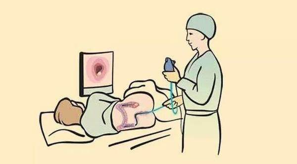 肠镜检查真的那么重要吗,肠镜检查无痛有风险吗