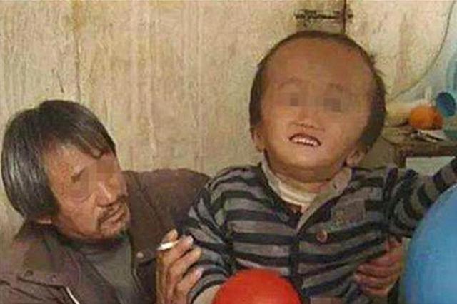 三聚氰胺毒奶粉老板出狱了吗,三聚氰胺奶粉受害儿童的现状