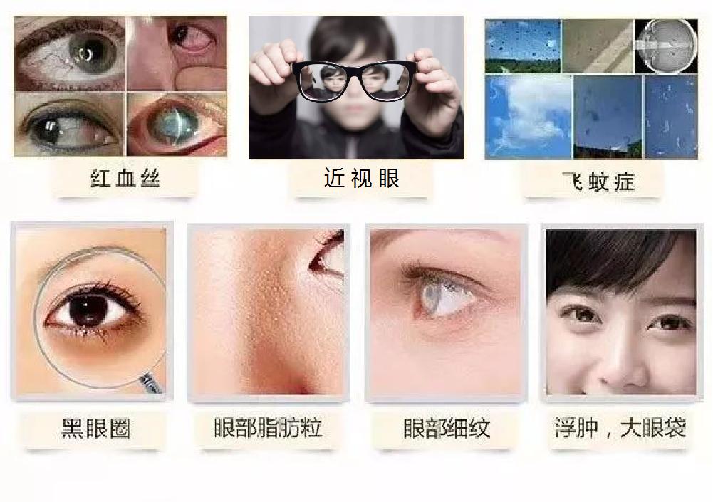 有哪些护眼和缓解眼睛疲劳小妙招,护眼小妙招1分钟快速缓解眼疲劳