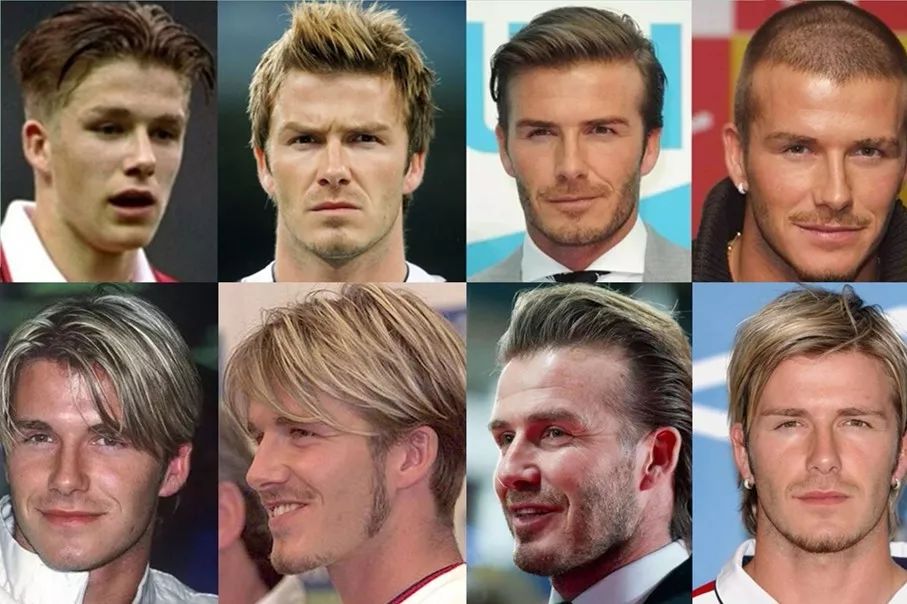 威廉王子秃顶了哈里为啥没秃顶,威廉王子为什么喜欢秃顶