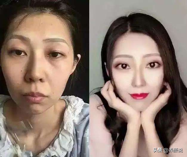 干皮如何淡化抬头纹和皱纹,去除抬头纹用什么护肤品