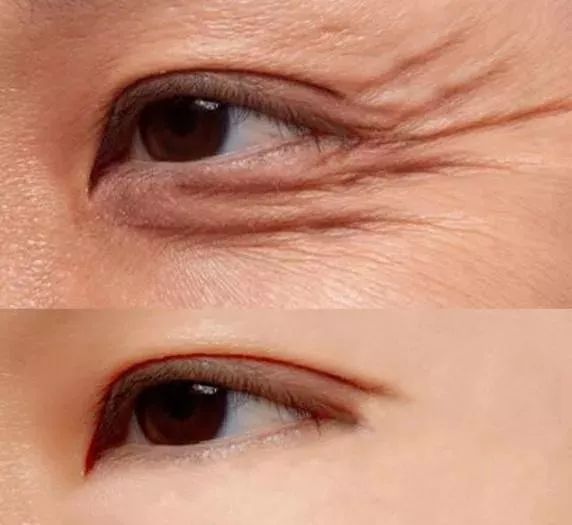 用过最良心的眼霜是哪一款,40岁左右公认最好用的眼霜老国货