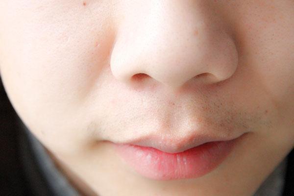 鼻子两侧有白色颗粒怎么去除,鼻子有白色的小颗粒怎么去除