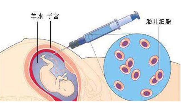 唐筛什么情况下需要做羊水穿刺,唐筛过了有必要做羊水穿刺吗