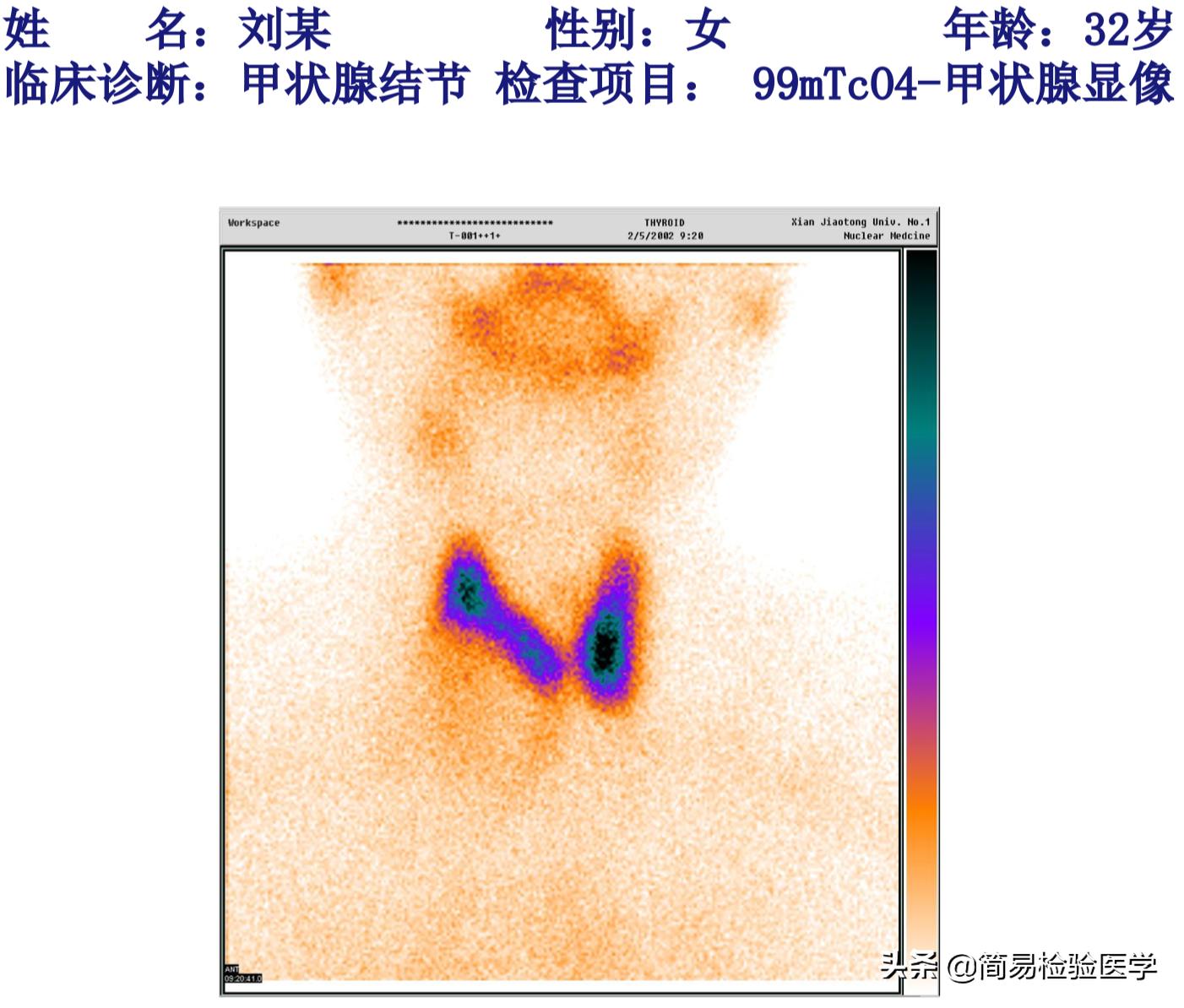 外科甲状腺疾病的思维导图,一秒看懂甲状腺报告单趣味讲解