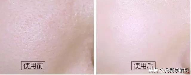 冬天脸干，连皱纹都出来了？日本女博士教你一招，抹几下白白嫩嫩