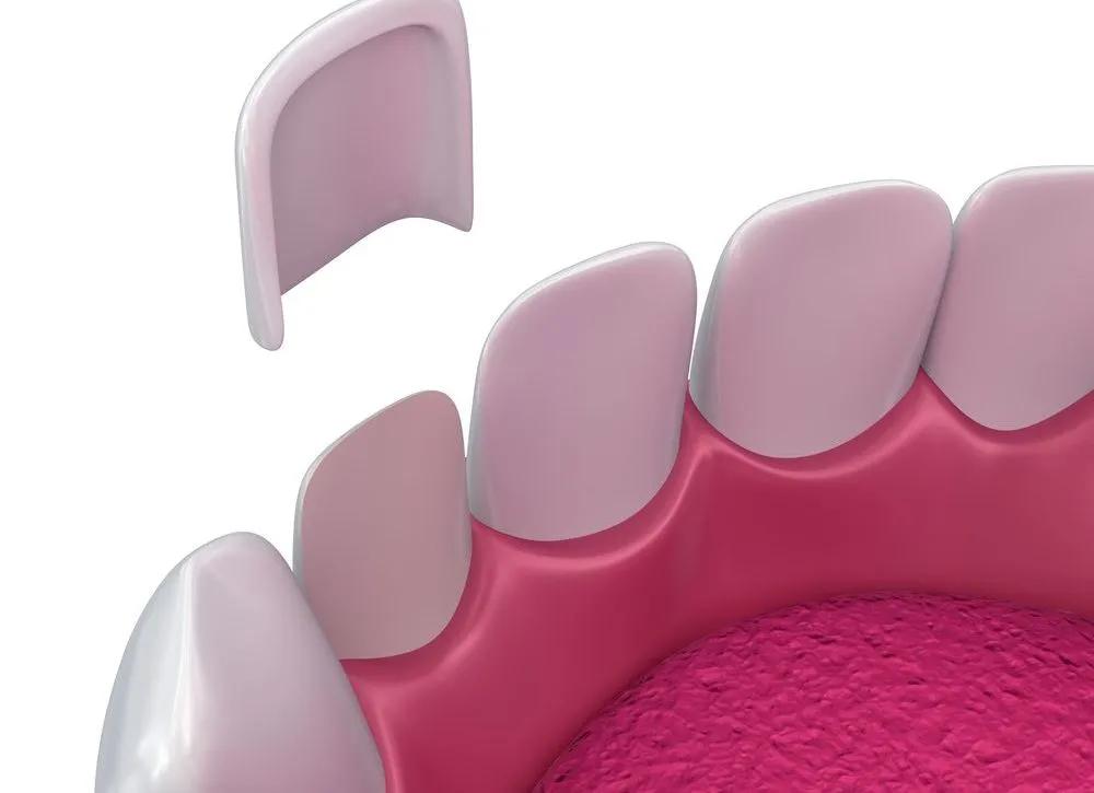 如何让牙齿变白这些方法你知道吗,口臭和牙黄用什么牙膏让牙齿变白