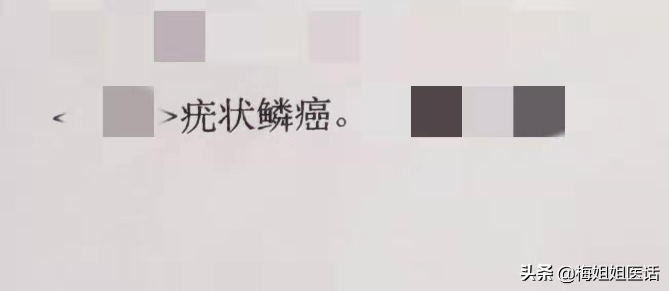 手皮疹越来越痒,拒绝瘙痒