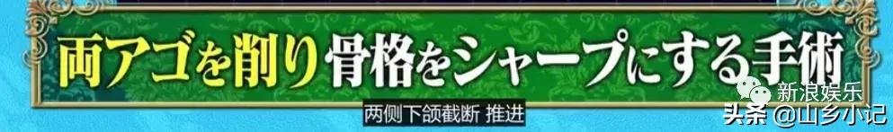 明明是整容脸现在却成了颜值巅峰,明明是整容脸却没被吐槽过