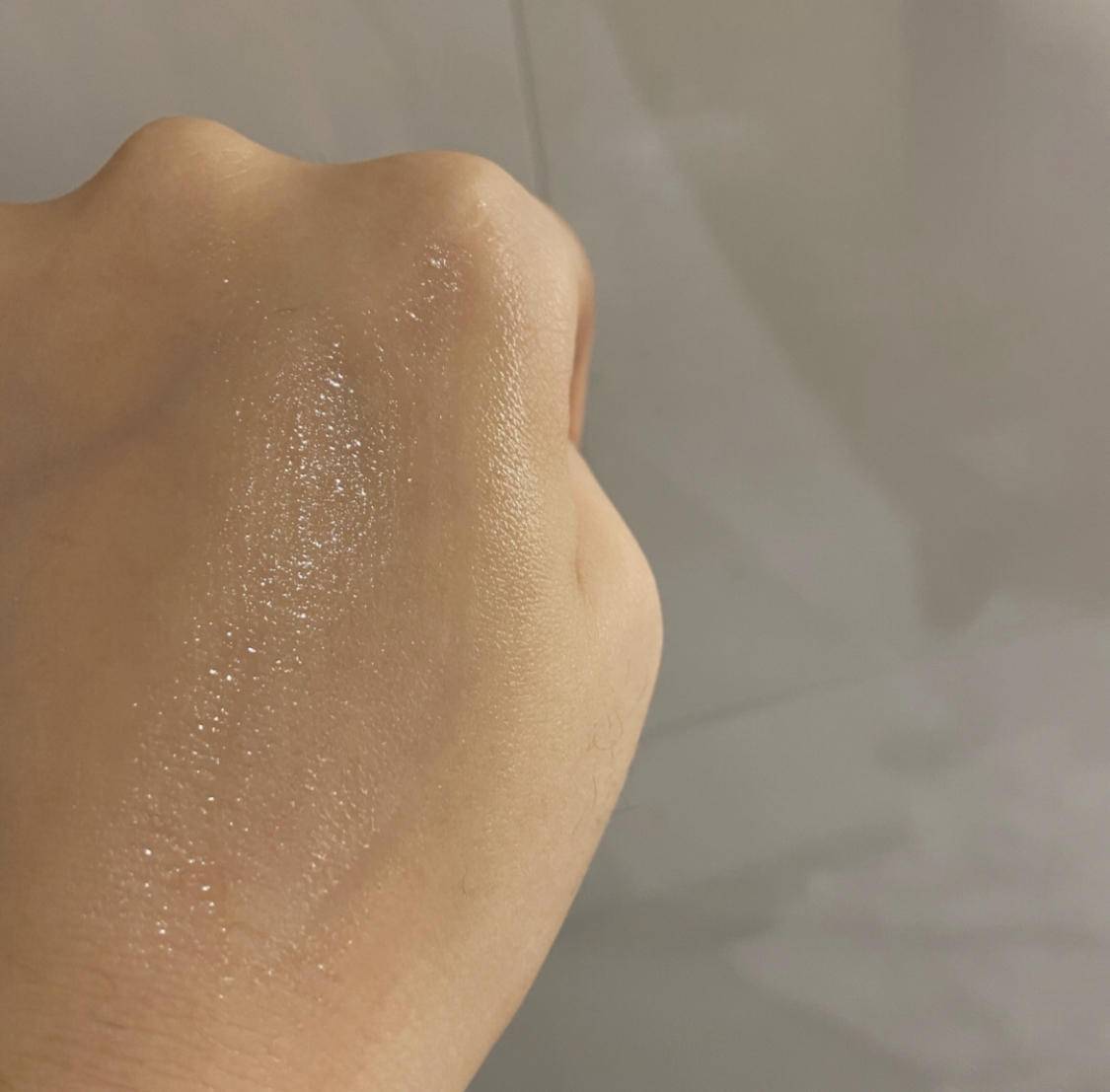 痘痘痘印的正确处理方法,痘痘留下的痘印应如何正确处理