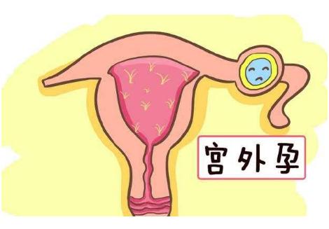 孕期发现出血需要做什么检查,孕期出血原因不明