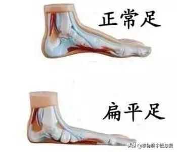 膝关节增生疼痛偏方,四神煎治膝关节疼痛