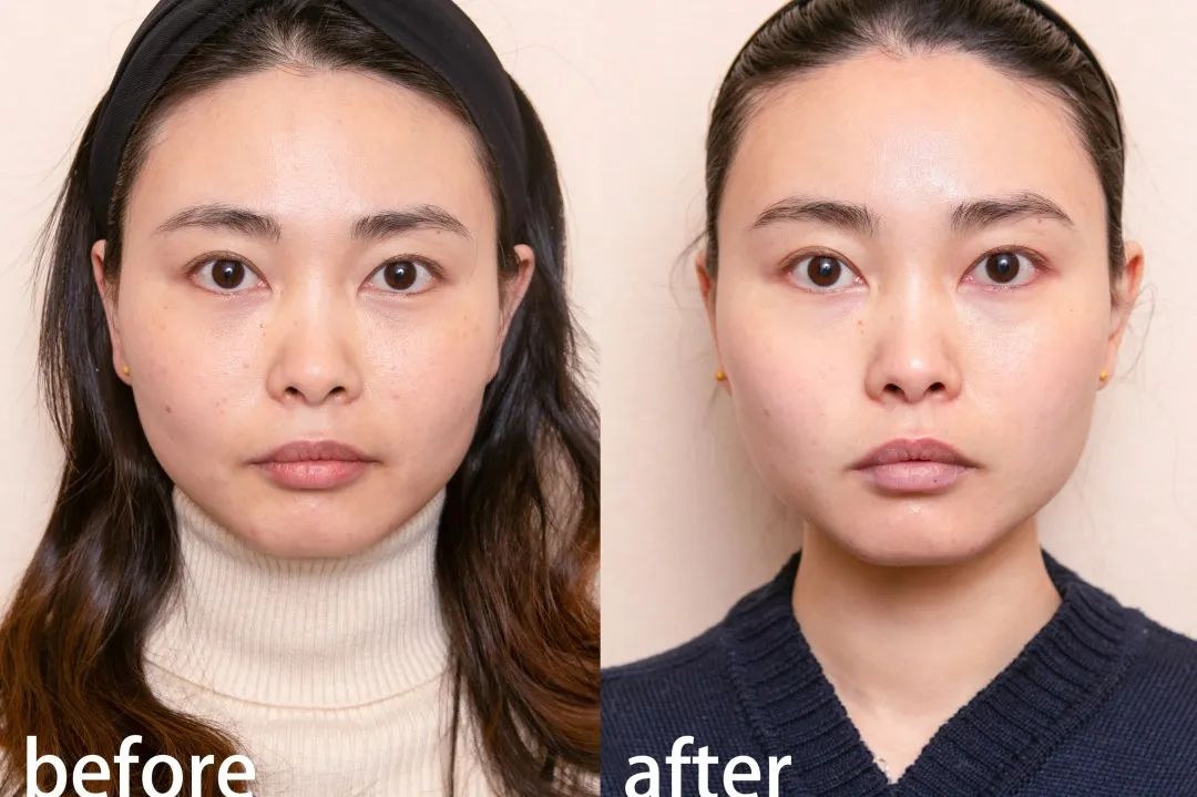 小茂医生美白护肤品,小茂教你如何护肤