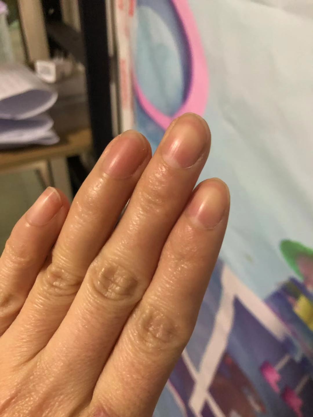 手指上只有大拇指有半月牙怎么办,手指的半月牙越来越少是什么原因