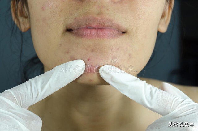 随着年龄增长人脸皮肤会变粗糙,人脸皮肤策划示意图