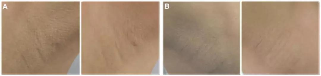 关于这个神仙成分，你不能不知道的秘密