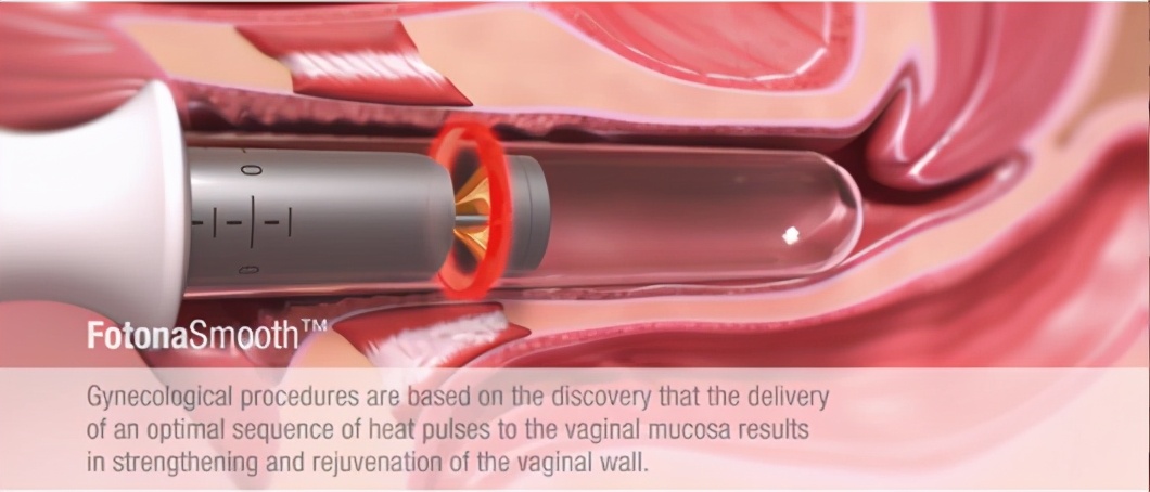 浜у悗瀹濆濡備綍鎭㈠鏉惧灝鍨殑鑲氱毊,瀹濆鎬庝箞鎭㈠绱ц嚧