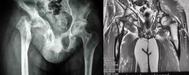 mri临床医师必读电子书,临床医生如何读mri