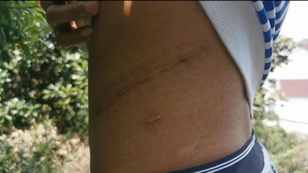 废弃厂房里的“卖肾”交易：买肾人花55万，卖肾人得4.5万！