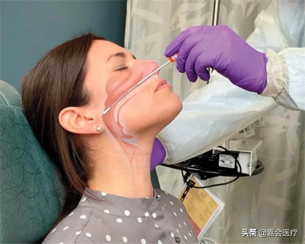 防疫常态化，鼻咽拭子采样，原来是这样操作的