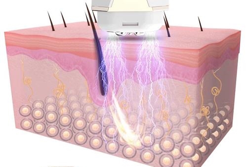 赵薇情深深雨蒙蒙重聚,情深深雨蒙蒙演员今昔对比赵薇