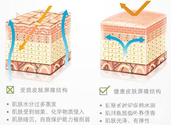 换季泛红脱皮怎么修复,皮肤泛红脱皮屏障受损