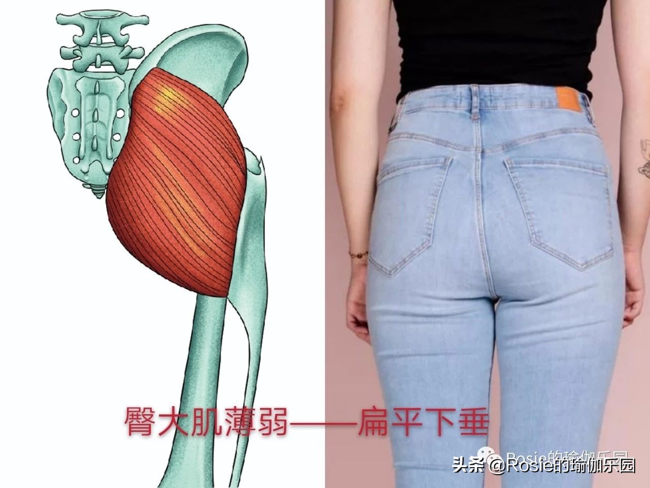 真翘臀和假翘臀怎么辨别,翘臀本来就有点骨盆前倾吗