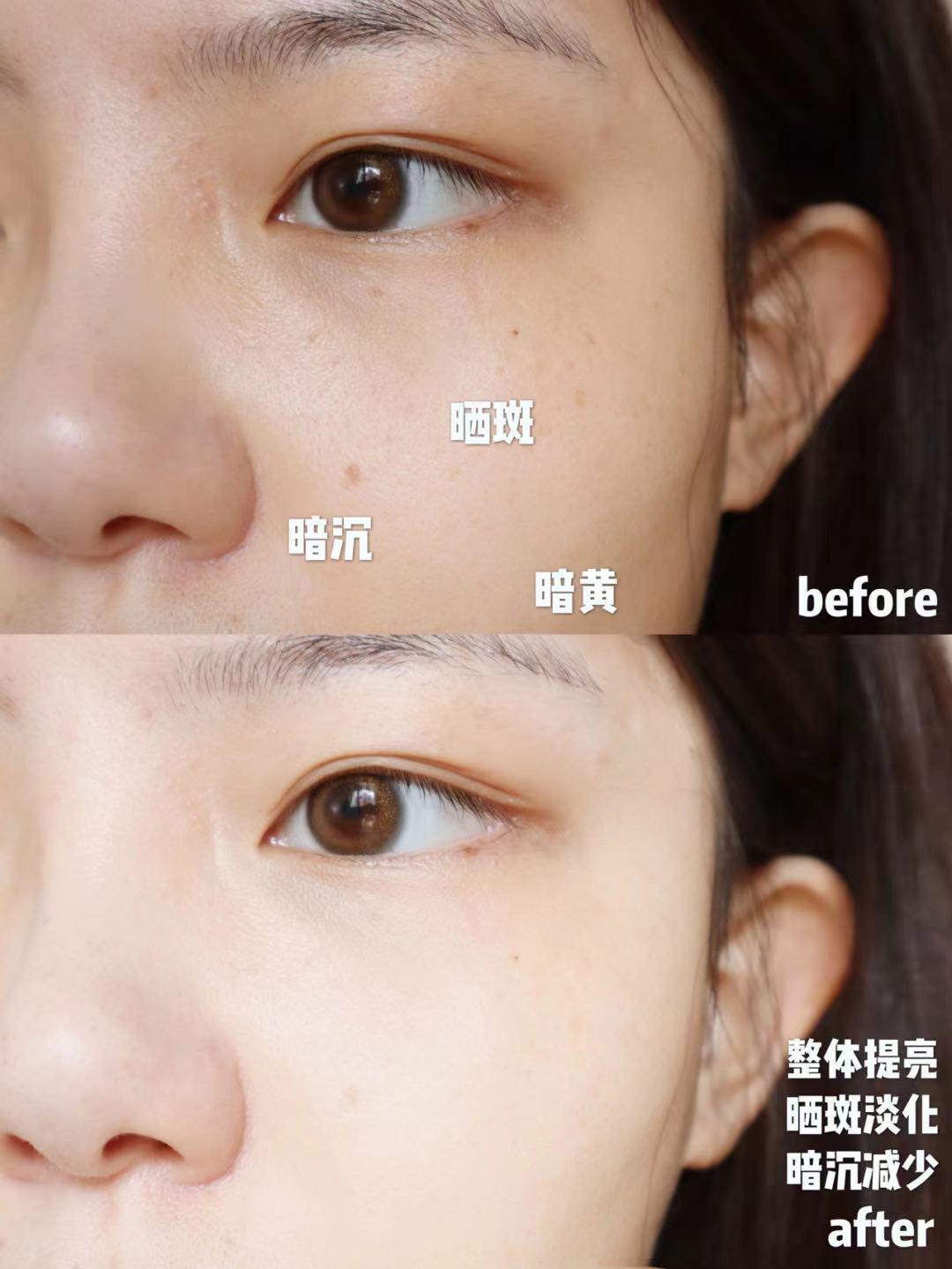 科颜氏淡斑小白瓶和小灯泡哪个好,科颜氏提亮美白