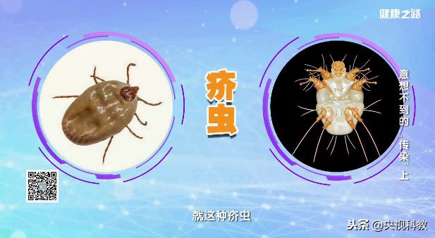 灰指甲足癣有什么偏方,灰指甲脚气湿疹