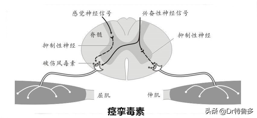 摔水泥地上擦伤会得破伤风吗,骑电车摔跤擦伤要打碎伤风吗