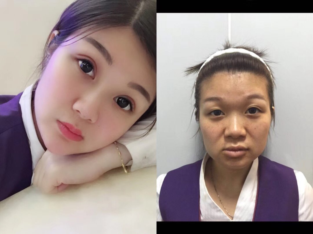 胶原蛋白如何补,胶原蛋白应该怎么补