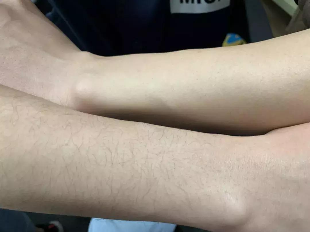 不做猕猴桃女孩是什么意思,不做猕猴桃女孩的图片