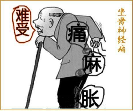 坐骨神经放射性疼痛几天自愈,坐骨神经痛14天自愈方法有哪些