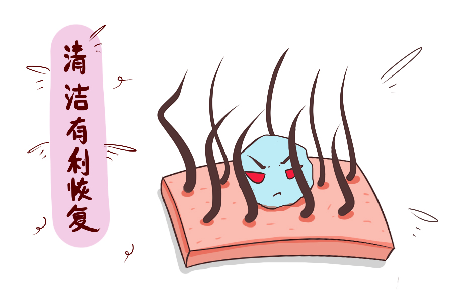 为什么生孩子之前产妇都要刮毛？这几个原因，即使再尴尬也会接受