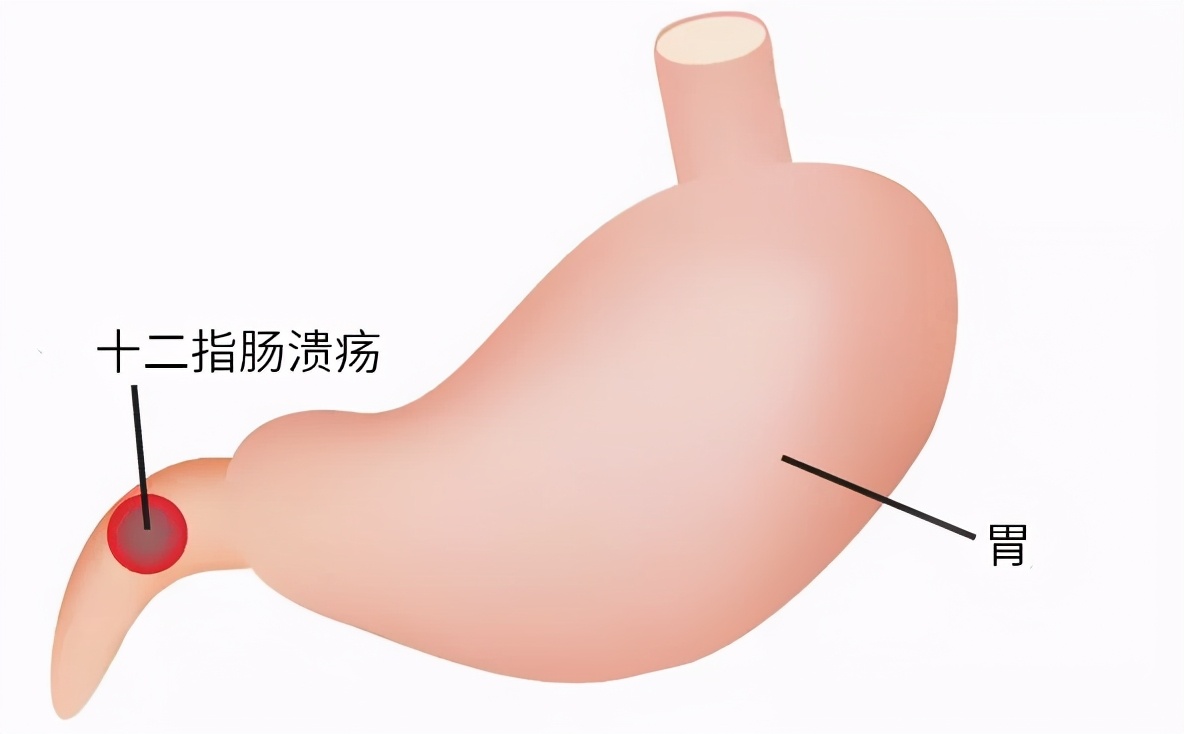 喝酒才是避免醉酒的最好办法,防止醉酒最快最有效的方法