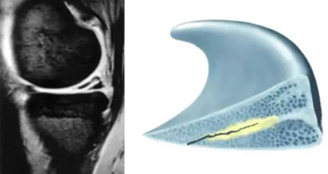 mri临床医师必读电子书,临床医生如何读mri