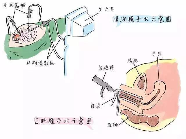 上海中医看子宫内膜息肉的专家,子宫内膜息肉名医
