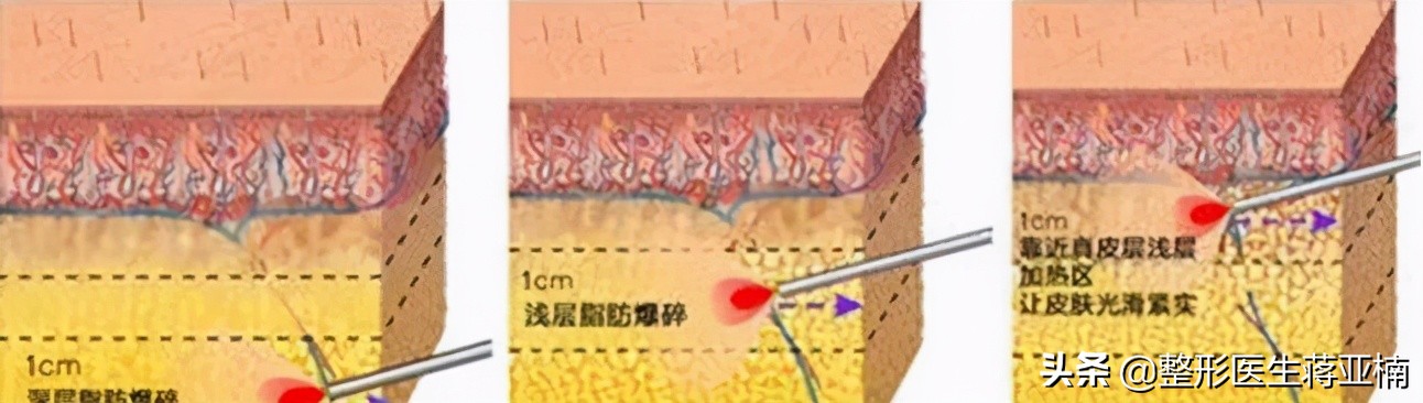 一次性说清,一次性说清要求